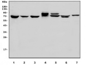 Western blot testing of 1) HeLa, 2) human Jurkat, 3) human PC-3, 4) monkey heart, 5) rat heart, 6) rat testis and 7) mouse heart lysate with PI16 antibody. Predicted molecular weight ~50 kDa, routinely observed at 70-110 kDa depending on glycosylation level.