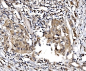 IHC staining of FFPE human bladder tissue with TBP-1 antibody. HIER: boil tissue sections in pH8 EDTA for 20 min and allow to cool before testing.