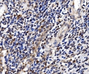 IHC staining of FFPE human appendicitis tissue with TBP-1 antibody. HIER: boil tissue sections in pH8 EDTA for 20 min and allow to cool before testing.