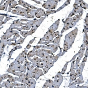 IHC staining of FFPE rat heart with TBP-1 antibody. HIER: boil tissue sections in pH8 EDTA for 20 min and allow to cool before testing.