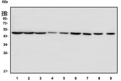 Western blot testing of human 1) HEK293, 2) HeLa, 3) HepG2, 4) MCF7, 5) U-2 OS, 6) PC-3, 7) U-87 MG, 8) rat stomach and 9) mouse lung lysate with TBP-1 antibody. Predicted molecular weight ~50 kDa.