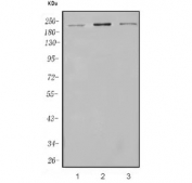 Western blot testing of human 1) HeLa, 2) Jurkat and 3) SH-SY5Y cell lysate with RAPGEF2 antibody. Predicted molecular weight ~167 kDa, observed at 200-220 kDa.
