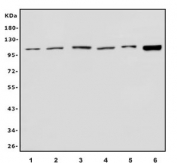 Western blot testing of 1) human HeLa, 2) human placenta, 3) monkey kidney, 4) rat kidney, 5) rat lung and 6) mouse kidney lysate with RAPGEF3 antibody. Predicted molecular weight ~104 kDa. 