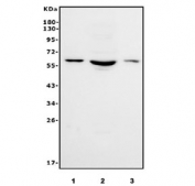 Western blot testing of human 1) A549, 2) Caco-2 and 3) A431 cell lysate with RBM47 antibody. Predicted molecular weight ~64 kDa.