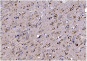 IHC staining of FFPE rat brain with TIMM8A antibody. HIER: boil tissue sections in pH8 EDTA for 20 min and allow to cool before testing.