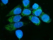 Immunofluorescent staining of FFPE human A431 cells with TIMM8A antibody (green) and DAPI nuclear stain (blue). HIER: steam section in pH6 citrate buffer for 20 min.