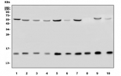 Western blot testing of human 1) HeLa, 2) MCF7, 3) PC-3, 4) K562, 5) HepG2, 6) monkey COS-7, 7) monkey kidney, 8) rat brain, 9) rat liver and 10) mouse liver lysate with TIMM8A antibody. Predicted molecular weight ~11 kDa.