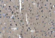 IHC staining of FFPE mouse brain with TMPRSS3 antibody. HIER: boil tissue sections in pH8 EDTA for 20 min and allow to cool before testing.