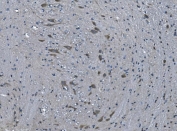 IHC staining of FFPE rat brain with TMPRSS3 antibody. HIER: boil tissue sections in pH8 EDTA for 20 min and allow to cool before testing.