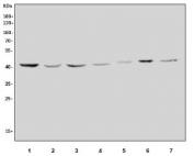 Western blot testing of 1) human MCF7, 2) human HepG2, 3) rat pancreas, 4) rat stomach, 5) rat PC-12, 6) mouse lung and 7) mouse RAW264.7 lysate with TMPRSS3 antibody. Predicted molecular weight ~48 kDa.
