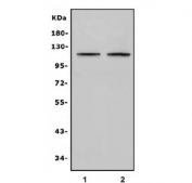 Western blot testing of human 1) HepG2 and 2) Caco-2 cell lysate with TRPA1 antibody. Predicted molecular weight ~120 kDa.