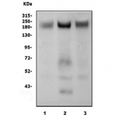 Western blot testing of 1) monkey skeletal muscle, 2) rat skeletal muscle and 3) mouse skeletal muscle lysate with CACNA1S antibody. Predicted molecular weight ~220 kDa.