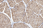 IHC staining of FFPE rat skeletal muscle with CACNA1S antibody. HIER: boil tissue sections in pH8 EDTA for 20 min and allow to cool before testing.