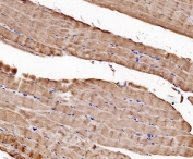IHC staining of FFPE human skeletal muscle with CACNA1S antibody. HIER: boil tissue sections in pH8 EDTA for 20 min and allow to cool before testing.