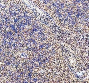 IHC staining of FFPE human spleen tissue with CDK12 antibody. HIER: boil tissue sections in pH8 EDTA for 20 min and allow to cool before testing.
