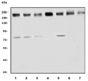 Western blot testing of human 1) HEK293, 2) HeLa, 3) Jurkat, 4) K562, 5) HL60, 6) Caco-2 and 7) A549 cell lysate with CDK12 antibody. Predicted molecular weight ~205 kDa.
