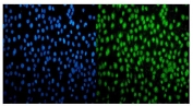 Immunofluorescent staining of FFPE human SiHa cells with CDK12 antibody (green) and DAPI nuclear stain (blue). HIER: steam section in pH6 citrate buffer for 20 min.