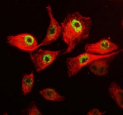 Immunofluorescent staining of FFPE human A549 cells with CDK12 antibody (green) and Beta Tubulin mAb (red). HIER: steam section in pH6 citrate buffer for 20 min.