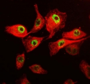 Immunofluorescent staining of FFPE human SiHa cells with CDK12 antibody (green) and DAPI nuclear stain (blue). HIER: steam section in pH6 citrate buffer for 20 min.