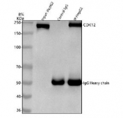 Immunoprecipitation of CDK12 protein from 500ug of human HepG2 whole cell lysate with 2ug of CDK12 antibody.