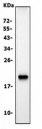 Western blot testing of mouse small intestine lysate with Cldn7 antibody. Predicted molecular weight ~22 kDa.