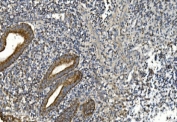 IHC staining of FFPE human appendicitis tissue with gp91phox antibody. HIER: boil tissue sections in pH8 EDTA for 20 min and allow to cool before testing.