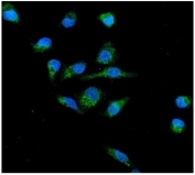 Immunofluorescent staining of FFPE human A549 cells with gp91phox antibody (green) and DAPI nuclear stain (blue). HIER: steam section in pH6 citrate buffer for 20 min.