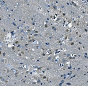 IHC staining of FFPE mouse brain tissue with DNAJC6 antibody. HIER: boil tissue sections in pH8 EDTA for 20 min and allow to cool before testing.