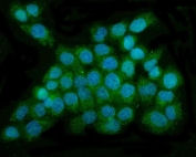 Immunofluorescent staining of FFPE human A431 cells with DNAJC6 antibody (green) and DAPI nuclear stain (blue). HIER: steam section in pH6 citrate buffer for 20 min.