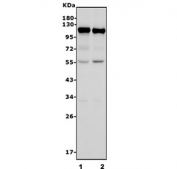 Western blot testing of 1) rat brain and 2) mouse brain lysate with DNAJC6 antibody. Predicted molecular weight ~120 kDa.