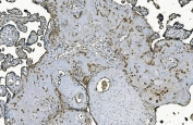IHC staining of FFPE human placenta with DNAJC10 antibody. HIER: boil tissue sections in pH8 EDTA for 20 min and allow to cool before testing.