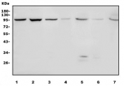 Western blot testing of 1) human HeLa, 2) human HepG2, 3) human U-87 MG, 4) rat stomach, 5) rat RH35, 6) mouse stomach and 7) mouse HEPA1-6 lysate with DNAJC10 antibody. Predicted molecular weight ~91 kDa.