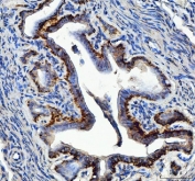 IHC staining of FFPE mouse ovary with Elongation Factor 2 antibody. HIER: boil tissue sections in pH8 EDTA for 20 min and allow to cool before testing.