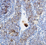 IHC staining of FFPE rat ovary with Elongation Factor 2 antibody. HIER: boil tissue sections in pH8 EDTA for 20 min and allow to cool before testing.