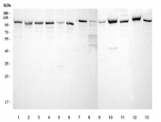 Western blot testing of 1) human Jurkat, 2) monkey COS-7, 3) human HeLa, 4) human 293T, 5) human HepG2, 6) human Daudi, 7) human MCF7, 8) zebrafish, 9) rat stomach, 10) rat pancreas, 11) rat C6, 12) mouse pancreas and 13) mouse 3T3L1 cell lysate with Elongation Factor 2 antibody. Predicted molecular weight ~95 kDa.