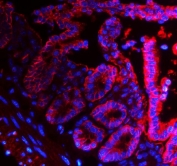 Immunofluorescent staining of FFPE mouse intestine with Epcam antibody (red) and DAPI nuclear stain (blue). HIER: steam section in pH8 EDTA for 20 min.
