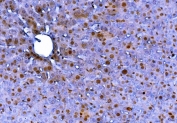 IHC staining of FFPE mouse liver with Fadd antibody. HIER: boil tissue sections in pH8 EDTA for 20 min and allow to cool before testing.