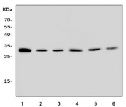 Western blot testing of 1) rat brain, 2) rat thymus, 3) rat PC-12, 4) mouse brain, 5) mouse thymus and 6) mouse NIH 3T3 lysate with Fadd antibody. Predicted molecular weight ~23 kDa, commonly observed at 23-28 kDa.