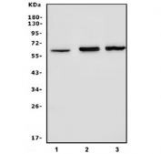 Western blot testing of 1) human SH-SY5Y, 2) rat brain and 3) mouse brain lysate with FEZF1 antibody. Predicted molecular weight ~ 52 kDa.