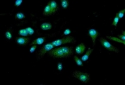 Immunofluorescent staining of FFPE human PC-3 cells with FEZF1 antibody (green) and DAPI nuclear stain (blue). HIER: steam section in pH6 citrate buffer for 20 min.