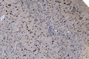 IHC staining of FFPE mouse brain with GABARAP antibody. HIER: boil tissue sections in pH8 EDTA for 20 min and allow to cool before testing.