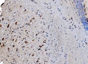 IHC staining of FFPE rat brain with GABARAP antibody. HIER: boil tissue sections in pH8 EDTA for 20 min and allow to cool before testing.