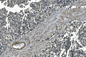 IHC staining of FFPE human testicular cancer with GNG7 antibody. HIER: boil tissue sections in pH8 EDTA for 20 min and allow to cool before testing.