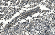 IHC staining of FFPE human testicular cancer with GNG7 antibody. HIER: boil tissue sections in pH8 EDTA for 20 min and allow to cool before testing.