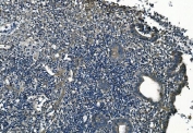 IHC staining of FFPE human appendicitis tissue with GNG7 antibody. HIER: boil tissue sections in pH8 EDTA for 20 min and allow to cool before testing.