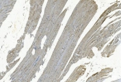 IHC staining of FFPE human skeletal muscle with GSTA4 antibody. HIER: boil tissue sections in pH8 EDTA for 20 min and allow to cool before testing.