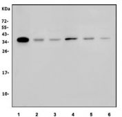 Western blot testing of 1) human COLO-320, 2) human U-2 OS, 3) human A549, 4) rat brain, 5) mouse brain and 6) mouse ovary lysate with HOXC8 antibody. Expected molecular weight: 27-35 kDa.