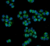Immunofluorescent staining of FFPE human T-47D cells with HOXC13 antibody (green) and DAPI nuclear stain (blue). HIER: steam section in pH6 citrate buffer for 20 min.