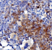 IHC staining of FFPE mouse spleen with Interleukin 3 antibody. HIER: boil tissue sections in pH8 EDTA for 20 min and allow to cool before testing.