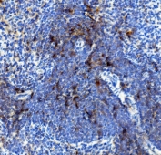 IHC staining of FFPE rat spleen with Il4 receptor antibody. HIER: boil tissue sections in pH8 EDTA for 20 min and allow to cool before testing.
